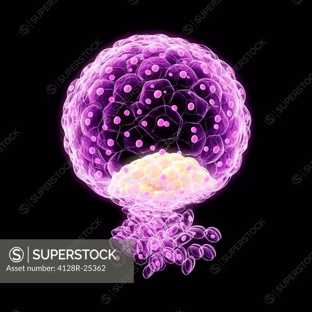 Implanted blastocyst. Computer artwork of a blastocyst embryo implanted in the wall of the uterus (womb).