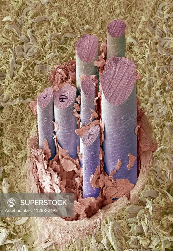 Dog hair, coloured scanning electron micrograph SEM.In dogs several hairs emerge from a single follicle.The collagen of the dermis has been exposed by...