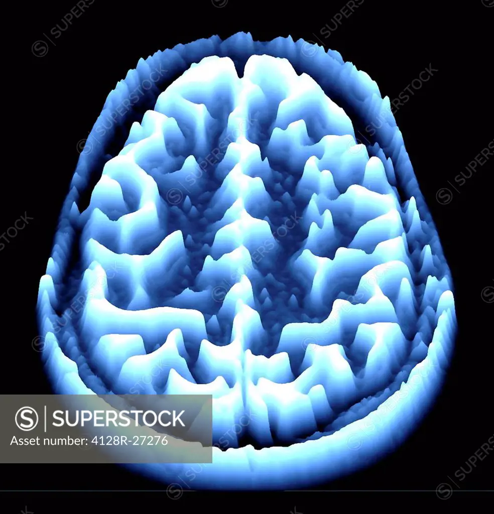 Normal brain. Coloured magnetic resonance imaging (MRI) scan of an axial section through a healthy brain, converted into a heightmap or height field. ...