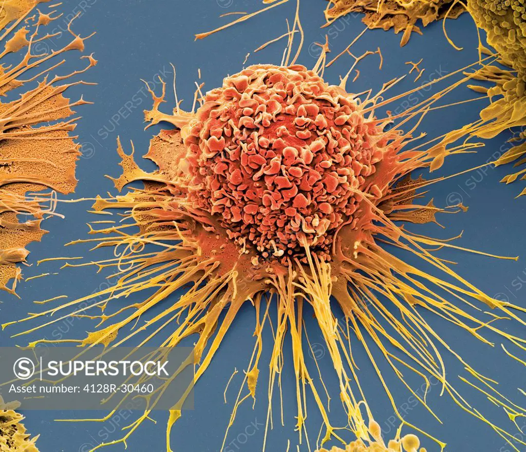 Activated human macrophage, coloured scanning electron micrograph (SEM). Magnification: x2,700 when printed at 10 centimetres wide.