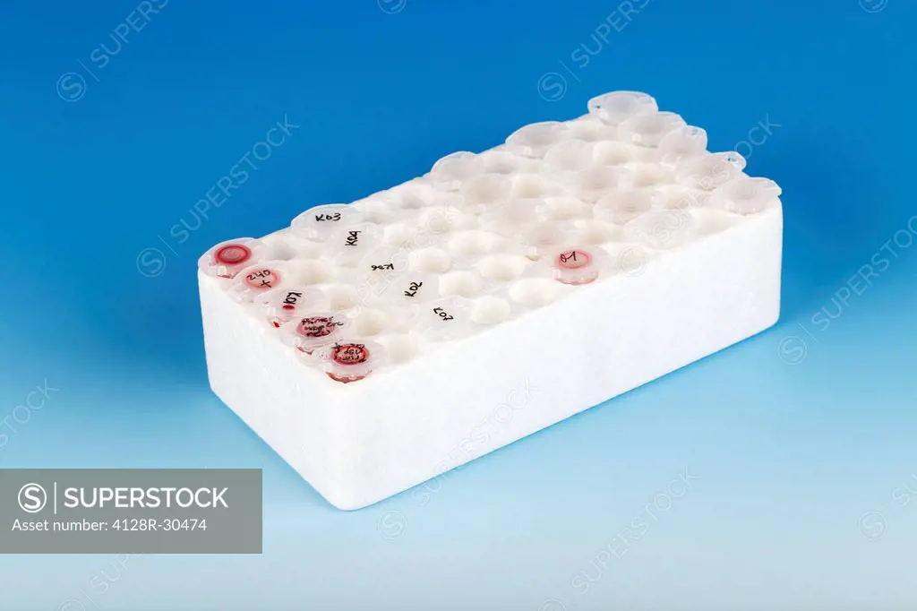Eppendorf tubes in a rack.