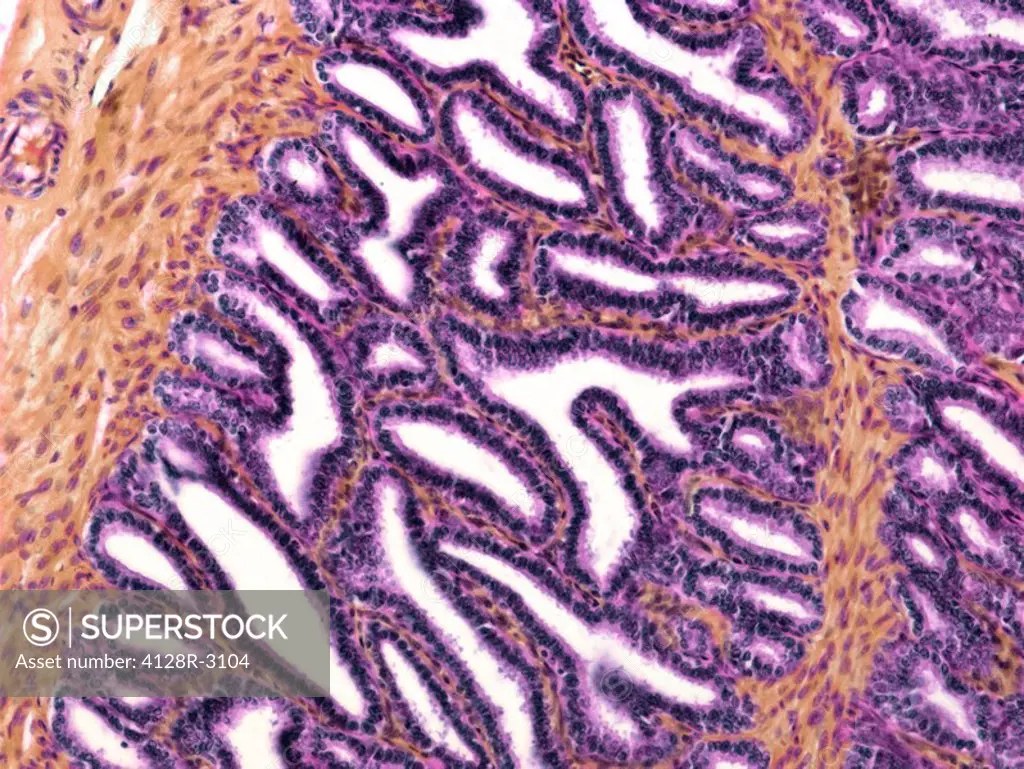 Seminal vesicle. Light micrograph of a section through the seminal vesicle showing the complex mucosal folding. Pseudostratified cuboidal epithelium o...