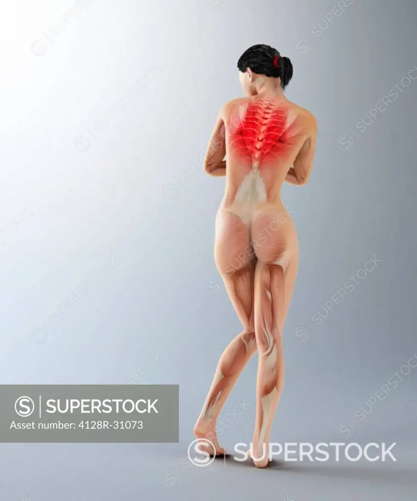 Upper back pain, conceptual computer artwork.