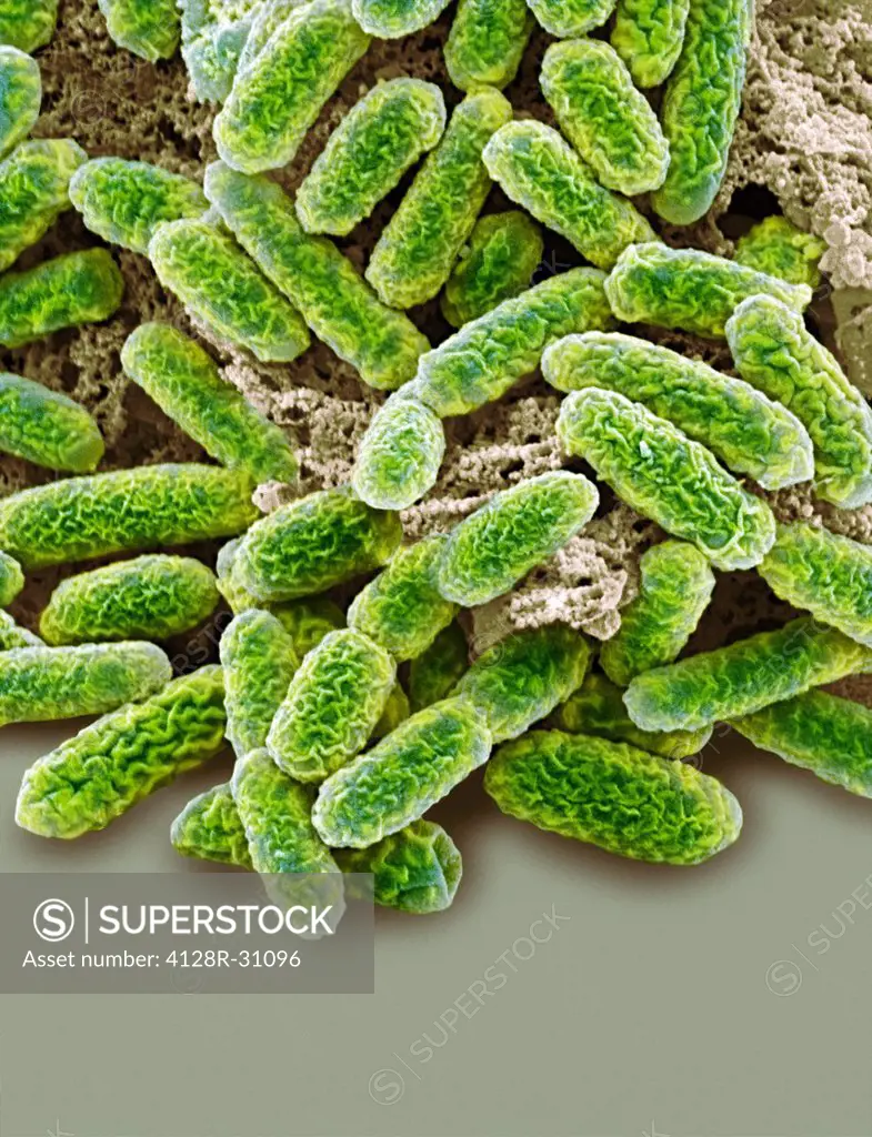 Escherichia coli bacteria, coloured scanning electron micrograph (SEM). Magnification: x10,000 when printed at 10 centimetres tall.