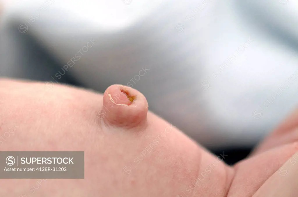 Two week old baby's belly button.