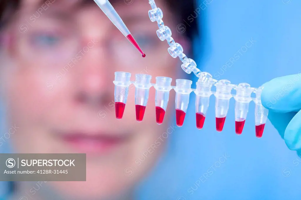 MODEL RELEASED. Haematology lab. Laboratory assistant using a pipette to transfer blood samples.
