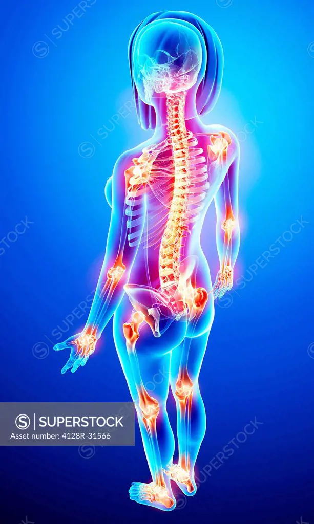 Joint pain, computer artwork.