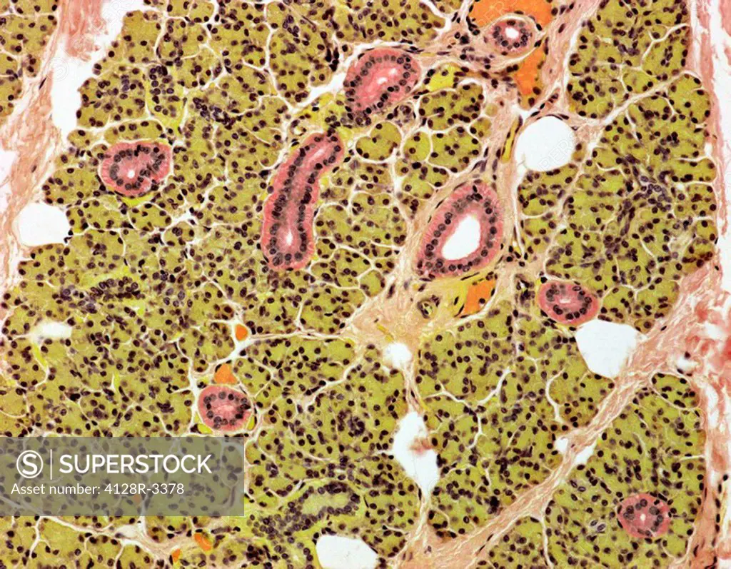 Parotid salivary gland. Light micrograph of a section through a parotid salivary gland showing serous acini yellow and their ducts pink. The parotid g...