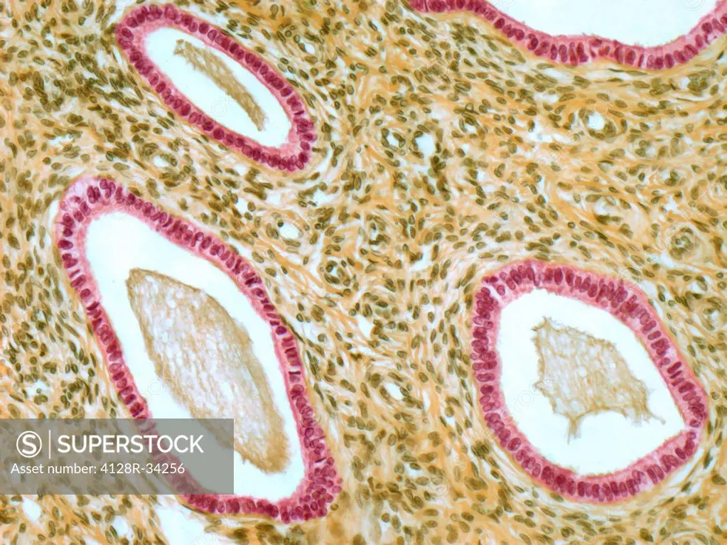 Cervix. Light micrograph of a section though the mucosa of the cervix, the neck of the uterus. The pink-lined areas are cervical glands, which produce...
