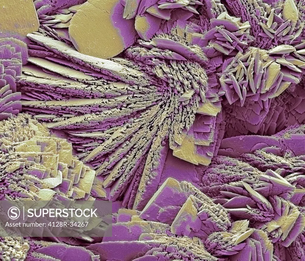 Limescale, coloured scanning electron micrograph (SEM). Limescale, which occurs when hard water is boiled, is composed of calcium or magnesium carbona...