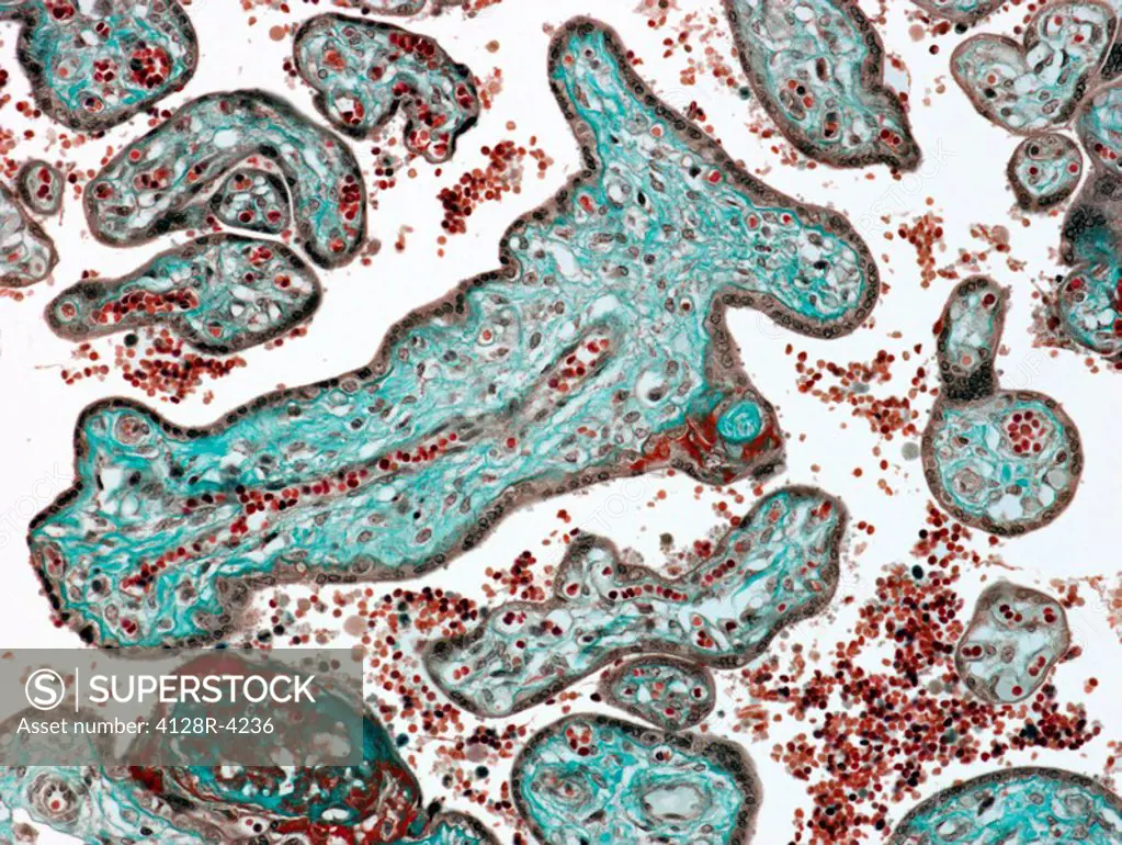 Placenta. Light micrograph of a section through a full term placenta showing numerous chorionic villi green. Their connective tissue carries branches ...