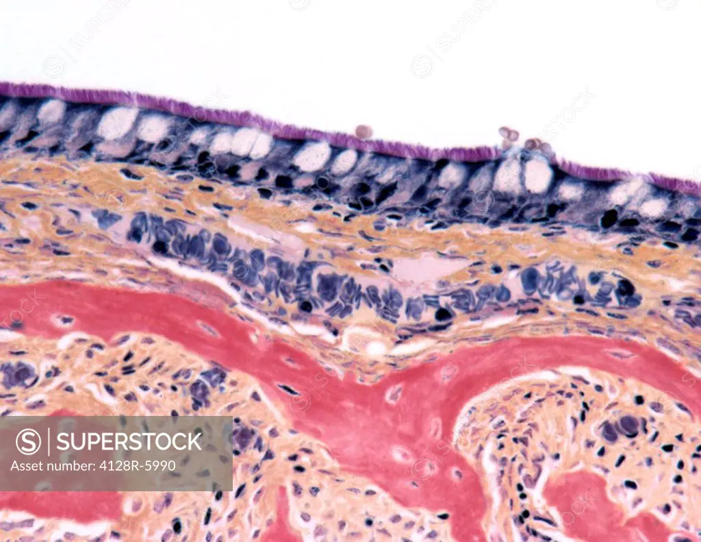 Nasal lining. Light micrograph of a section through the paranasal sinus epithelium showing ciliated cells purple and goblet cells white ovals. Magnifi...