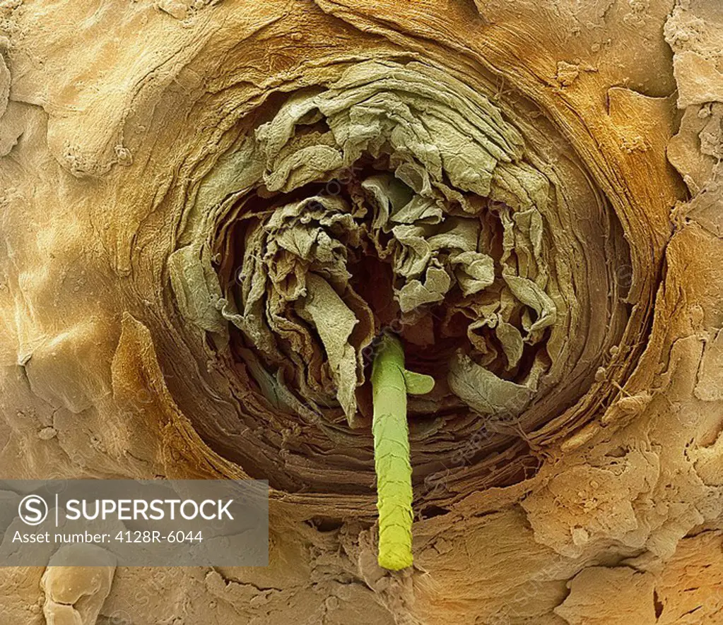 Eyelash follicle, coloured scanning electron micrograph SEM. Magnification: x400 when printed at 10 centimetres wide.