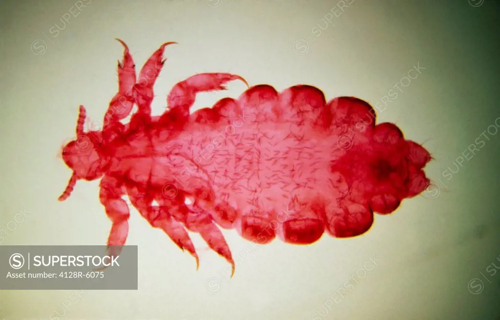 LM of a female human body louse, Pediculus humanis