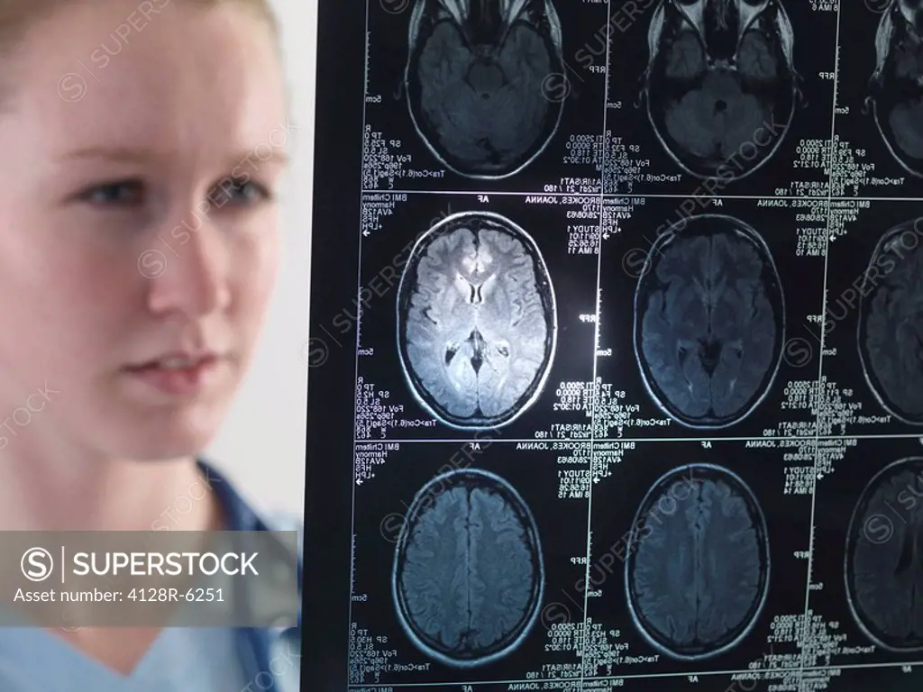 Doctor studying magnetic resonance imaging MRI brain scans.