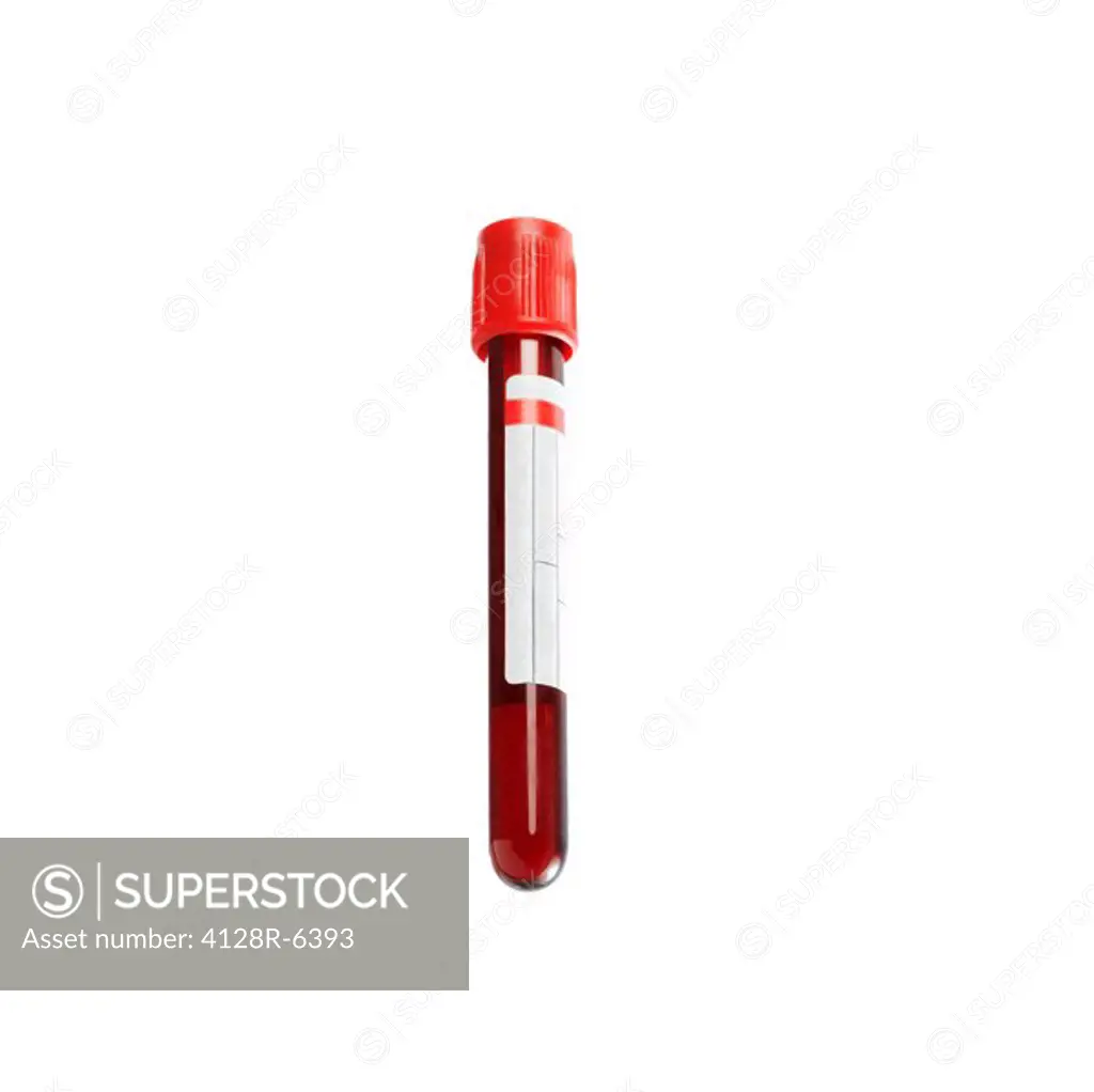 Blood sample.