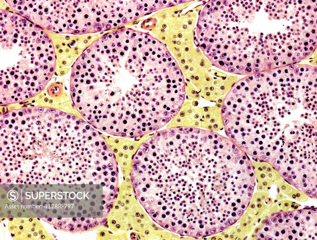 Seminiferous tubules. Coloured light micrograph of a section through the testis, showing seminiferous tubules pink and leydig cells yellow. This is th...