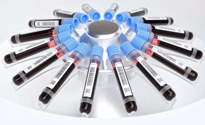 Centrifuging blood samples, illustration