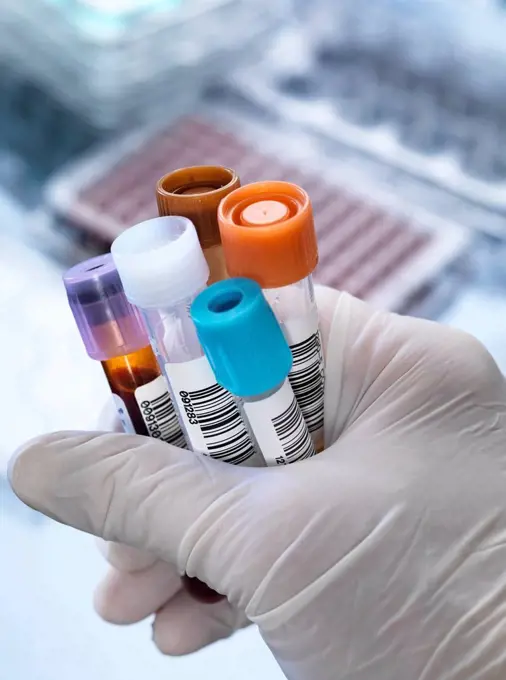 Technician holding a variety of human samples, including blood, chemistry and urine, for testing in a laboratory.
