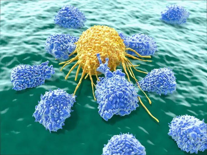 Illustration of lymphocytes attacking a cancer cell. Natural killer cells are a type of lymphocyte that destroys cancer cells and other altered cells ...