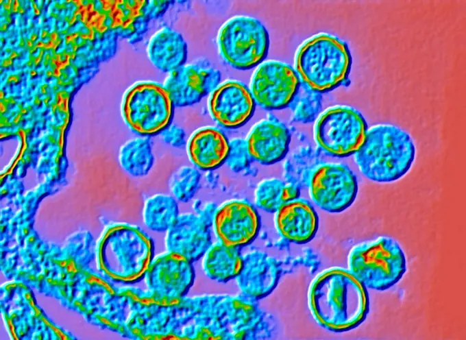 Color enhanced transmission electron micrograph (TEM) of Hantavirus particles. Hantavirus is a respiratory disease carried in wild rodents such as dee...
