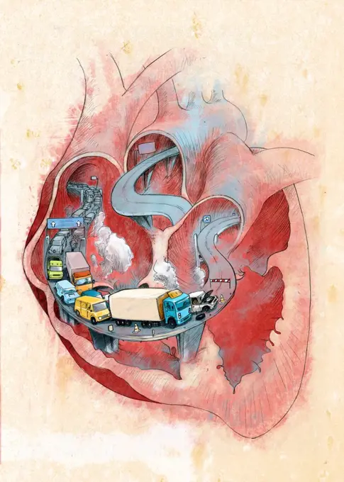 Clogged heart, conceptual illustration