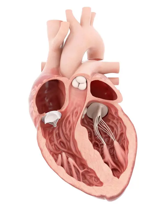 Illustration of an artificial heart valve