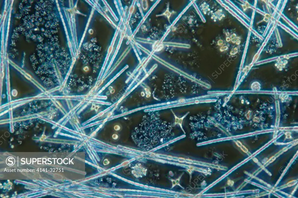 phytoplankton mixed species from eutrophic lake, mag.x80 anoptal contrast microscopy