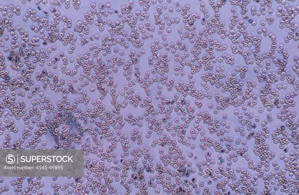 human erythrocytes, (red blood cells), displayed under microscope 