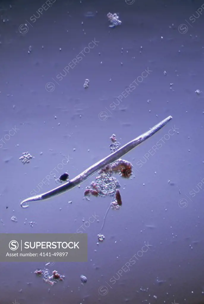 nematode or roundworm, ascaris sp., aquatic species under microscope 