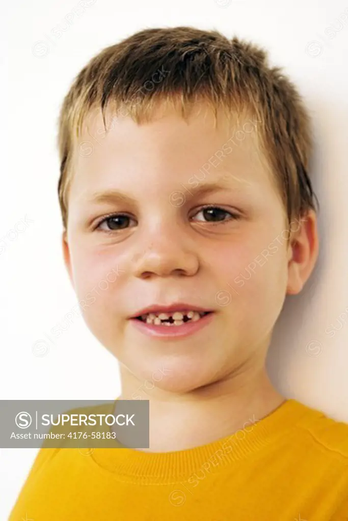 Young boy in orange t-shirt with gaps between his f