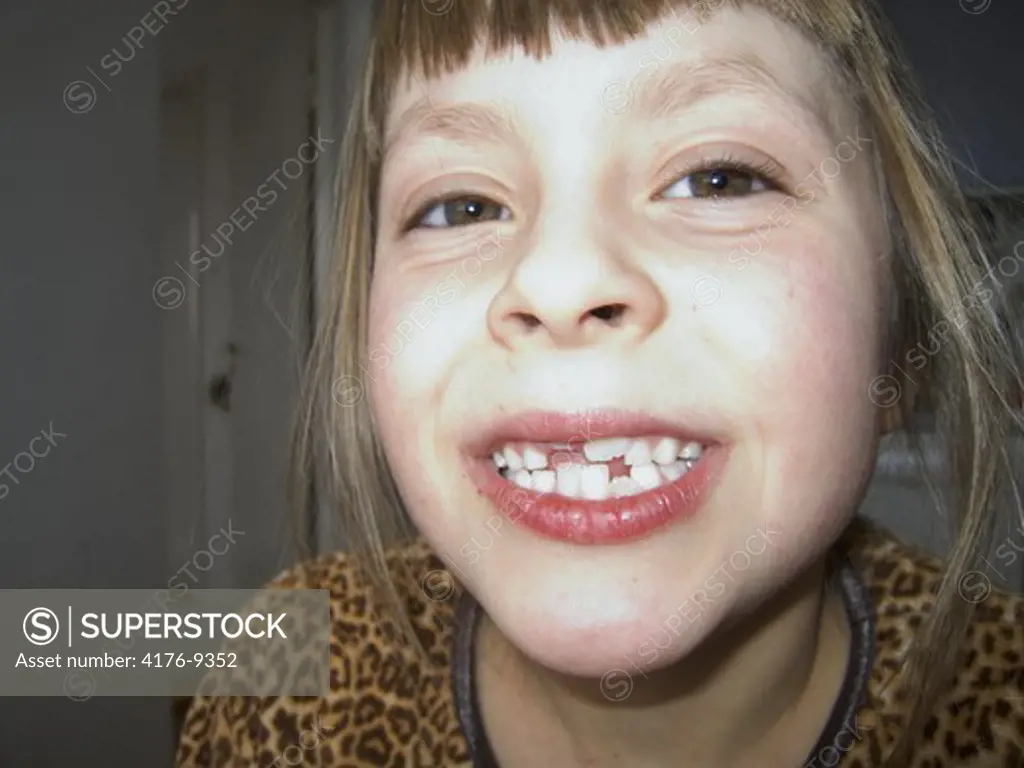A seven-year-old girl baring her milk teeth. Sweden