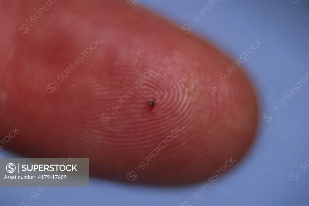 Deer Tick on human Finger, life size (Ixodes scapularis), Cause of Lyme disease