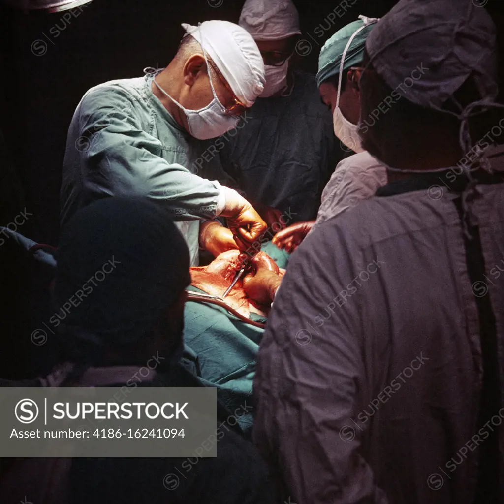 1960s 1970s ANONYMOUS TEAM OF LEAD SURGEON ASSISTANT SURGEONS AND NURSES IN MASKS AND GLOVED HANDS PERFORMING A MEDICAL SURGERY