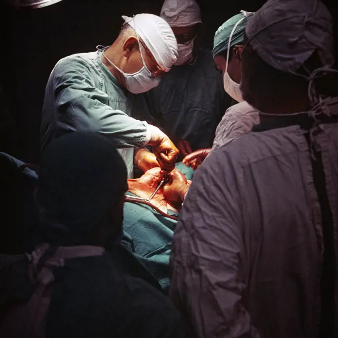 1960s 1970s ANONYMOUS TEAM OF LEAD SURGEON ASSISTANT SURGEONS AND NURSES IN MASKS AND GLOVED HANDS PERFORMING A MEDICAL SURGERY