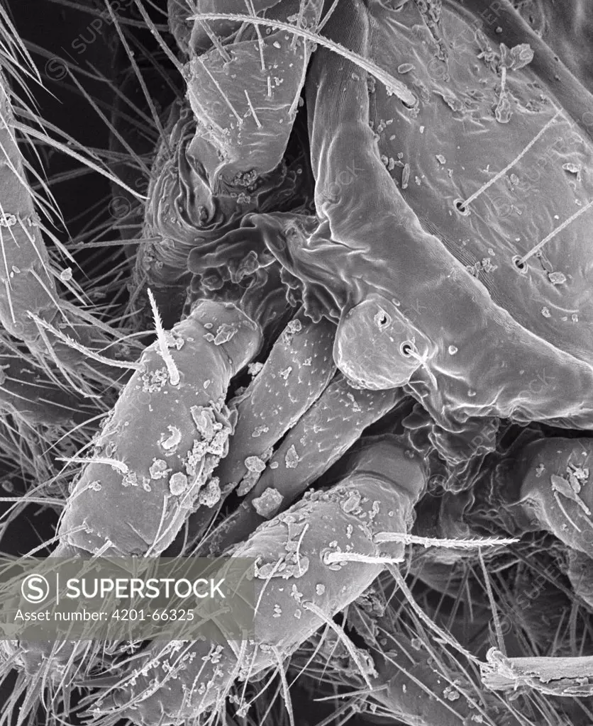 SEM close-up view of gnathosoma at 140x magnification
