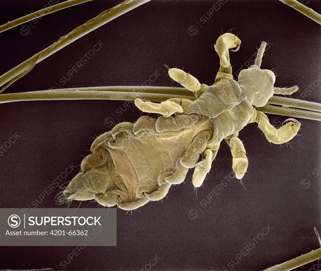 Human Louse (Pediculus humanus) SEM close-up view of individual between human hair at 28x magnification