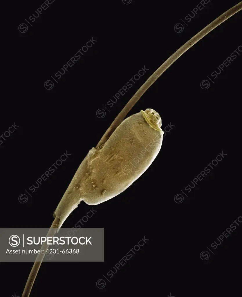 Human Louse (Pediculus humanus) SEM close-up view of egg on human hair at 35x magnification