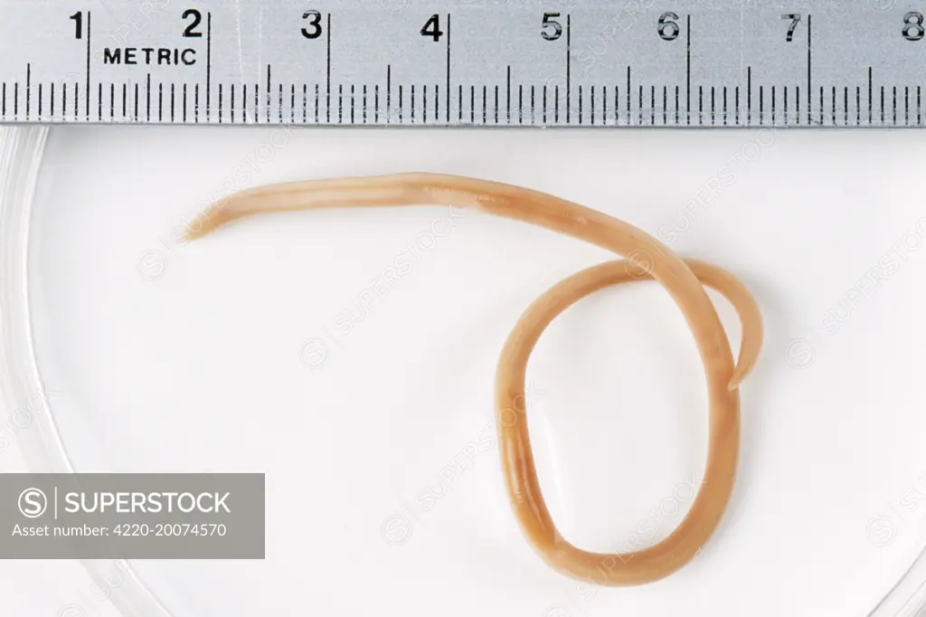 RoundWORM - From Cat (Toxocara cati)