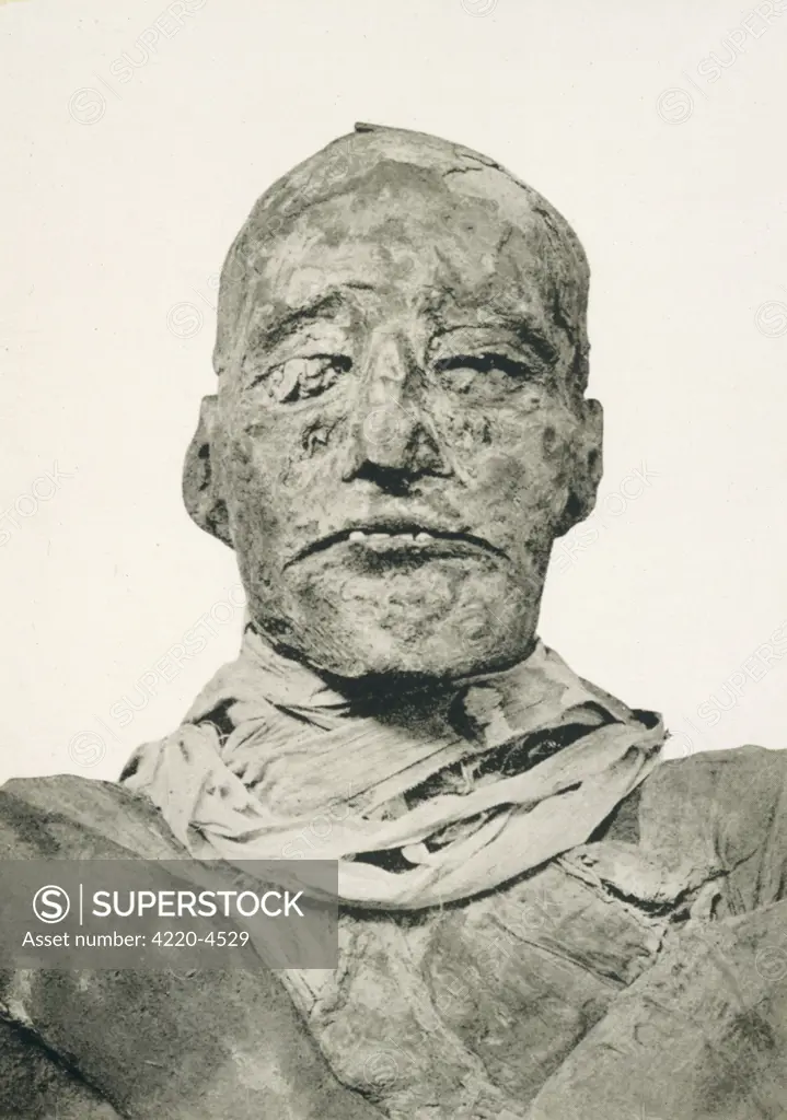 RAMESES III, PHARAOH (19th dynasty) Photograph of the head  of his mummy