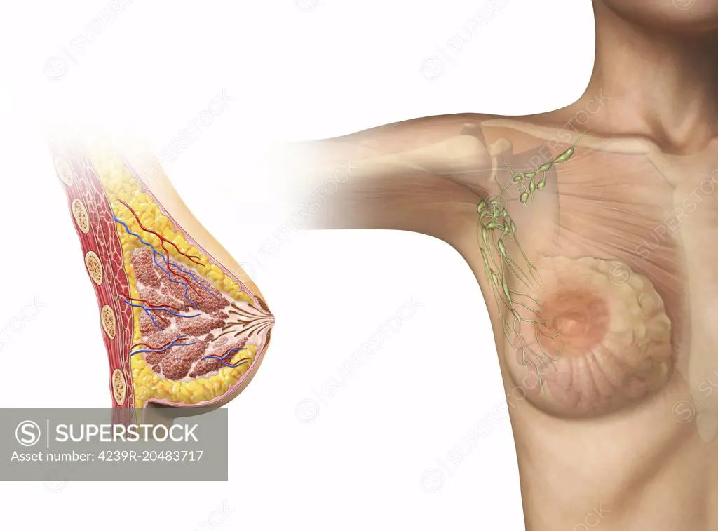 Woman Breast Implant Cross Section. Stock Illustration - Illustration of  female, anatomy: 39457636