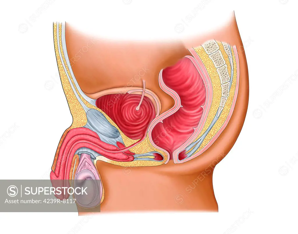 Medical illustration of a rectourethral fistula.
