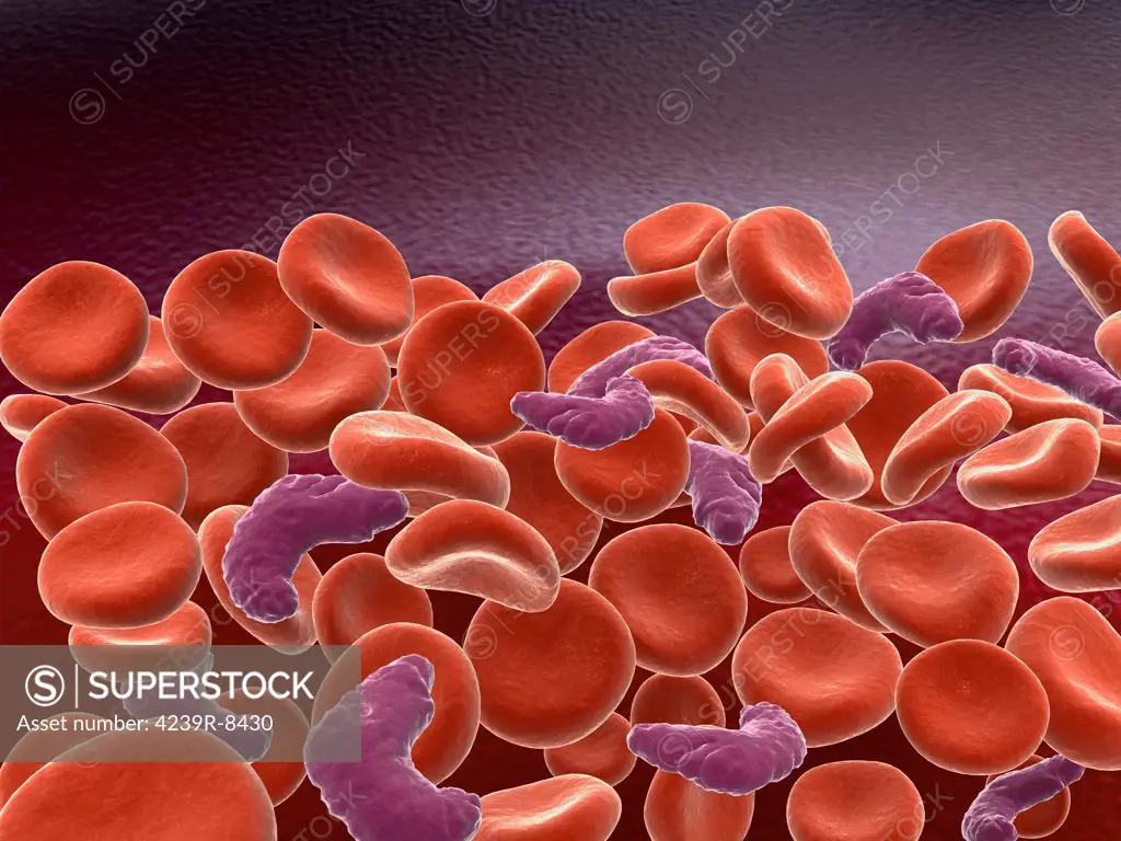 Conceptual image of sickle cell anemia with red blood cells.