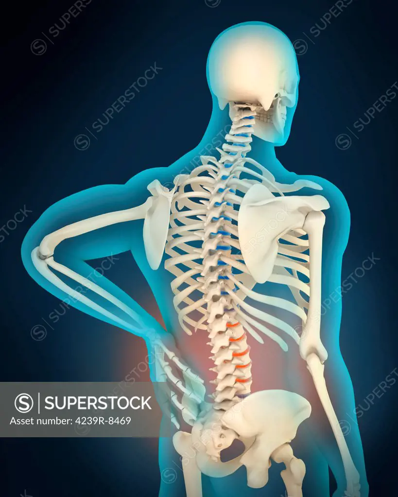 Medical illustration showing inflammation and pain in human back area, perspective view.