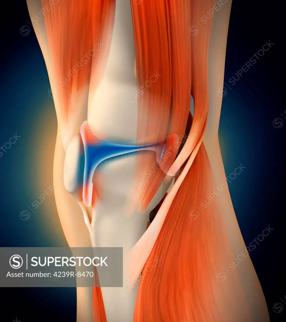 Medical illustration showing inflammation and pain in human knee joint, perspective view.