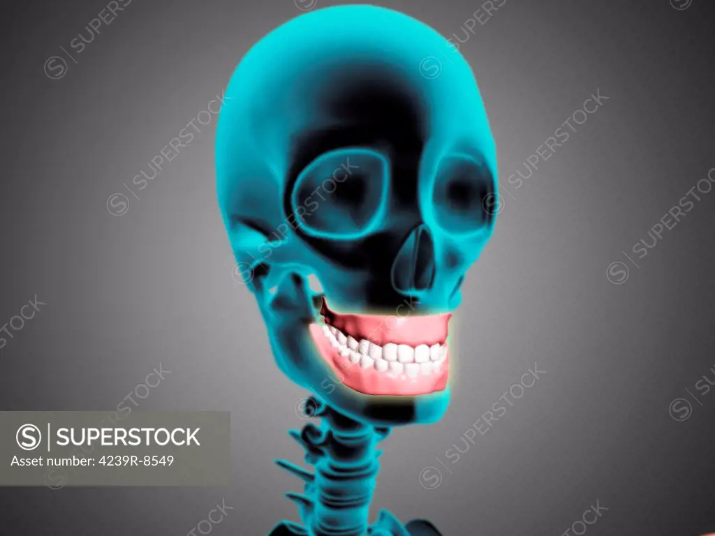 X-ray view of human skeleton showing teeth and gums.