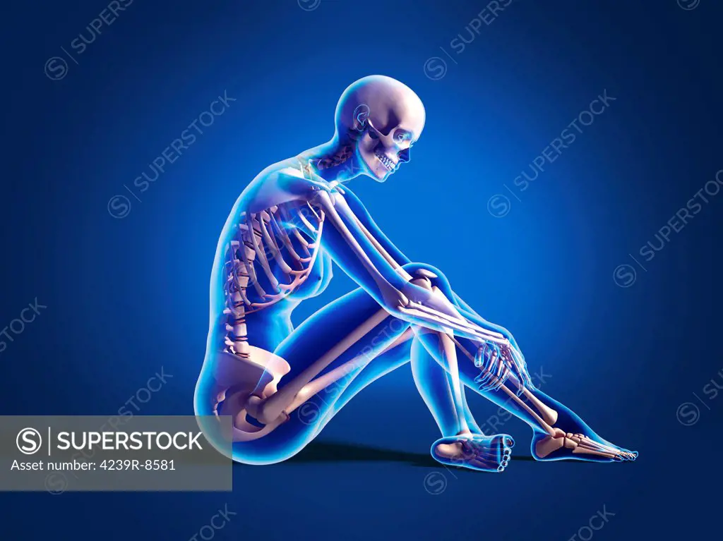 X-ray view of a naked woman sitting on floor, with skeletal bones superimposed.