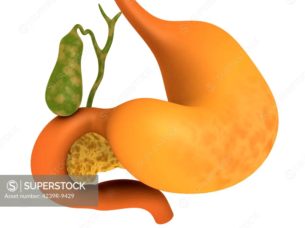Gall bladder with stomach.