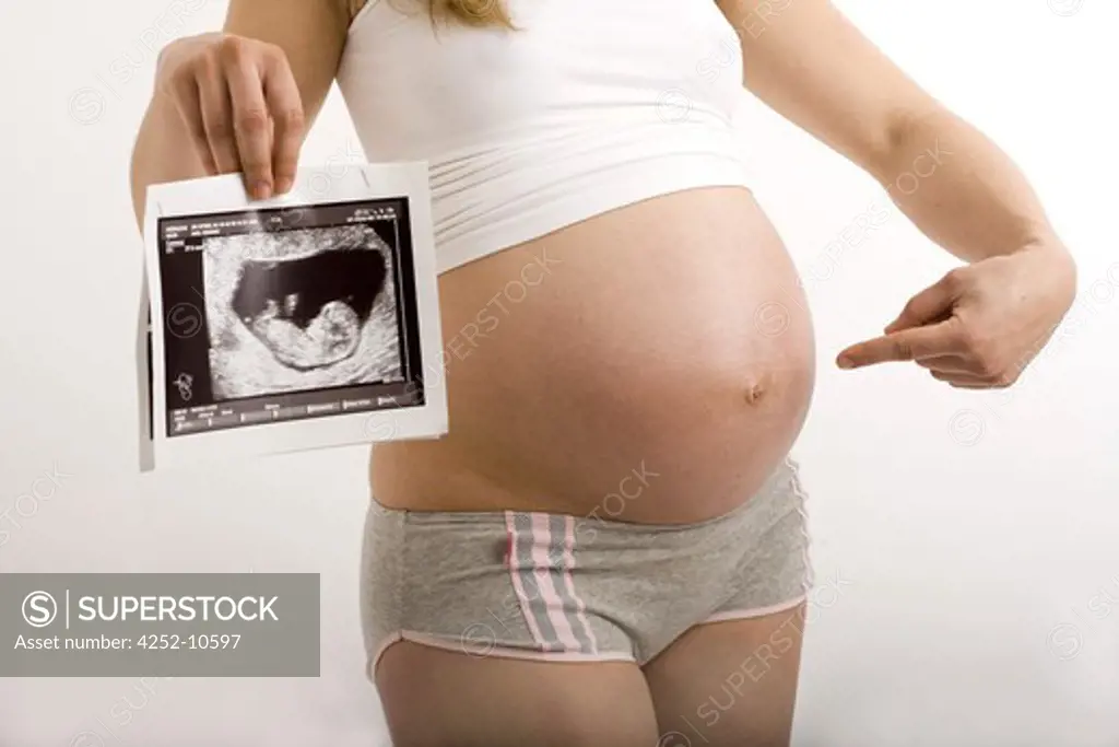 Pregnant woman echography