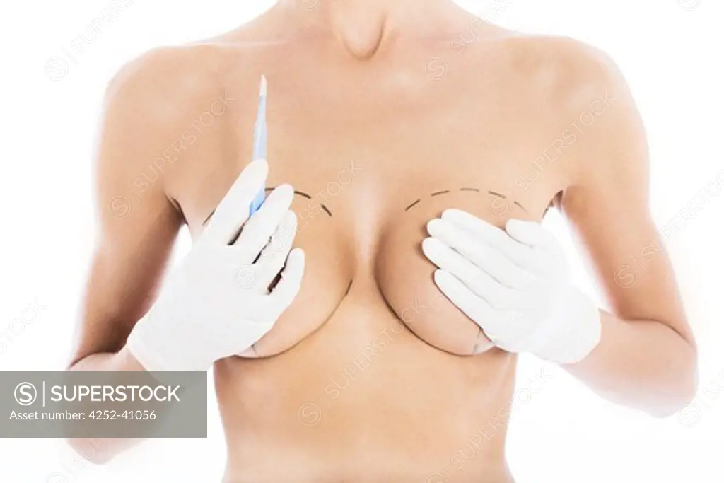 Woman breast surgery
